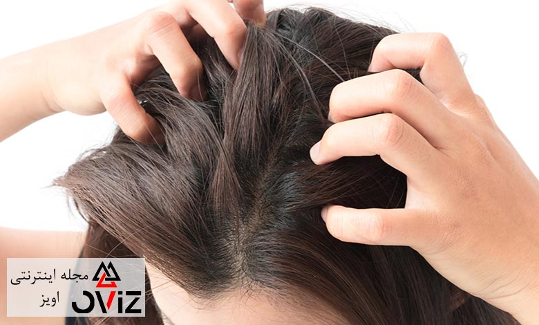 مشکلات شپش سر