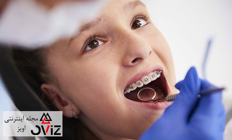 آیا ارتودنسی باعث لق شدن دندان می شود؟